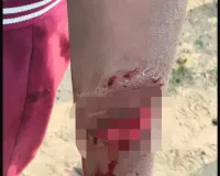 గోవిందపూర్, కోనాపూర్ గ్రామాలలో కుక్కల దాడి...